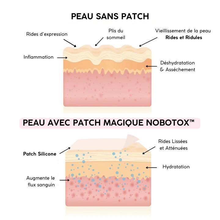 NoBotox™ - Patches Magiques Anti-Rides